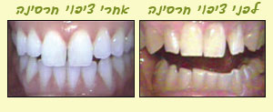 tipulim3a
